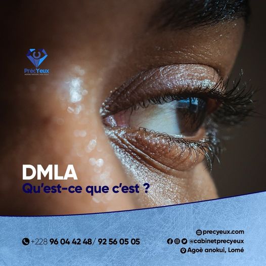 Read more about the article LA DMLA ou la Dégénérescence Maculaire Liée à l’Age